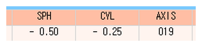 수술 후 굴절검사 값 - 구면 -0.50D 난시 -0.25D 축 19도