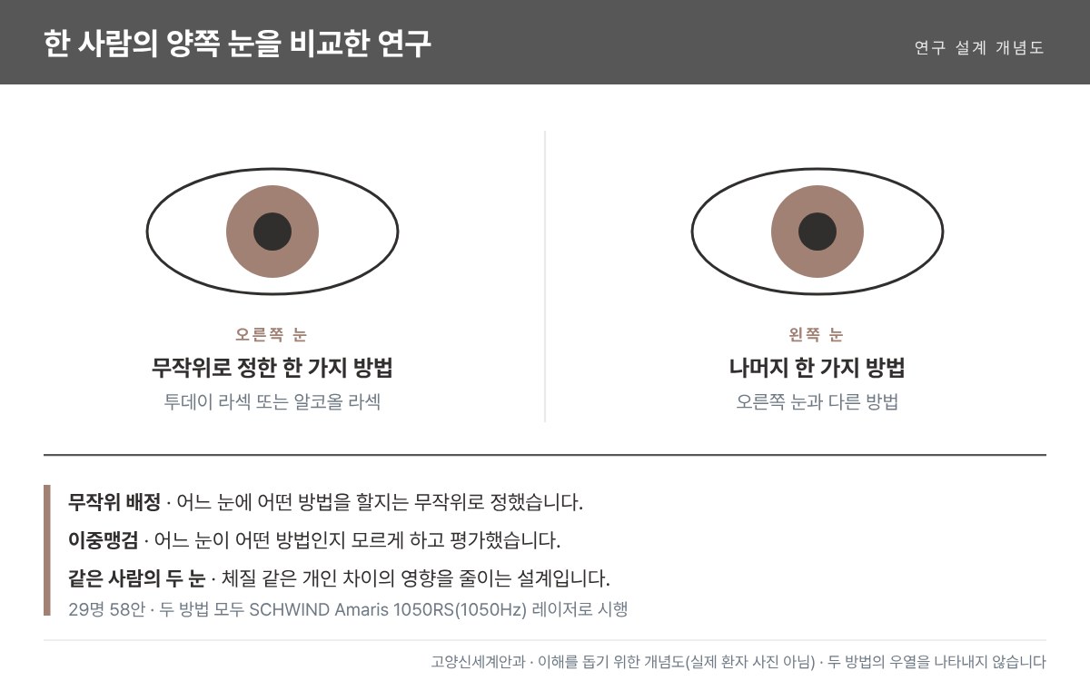 투데이 라섹 대측안 무작위 연구 설계 개념도 - 한 사람의 오른쪽 눈과 왼쪽 눈에 투데이 라섹과 알코올 라섹을 무작위로 하나씩 시행 - 고양신세계안과