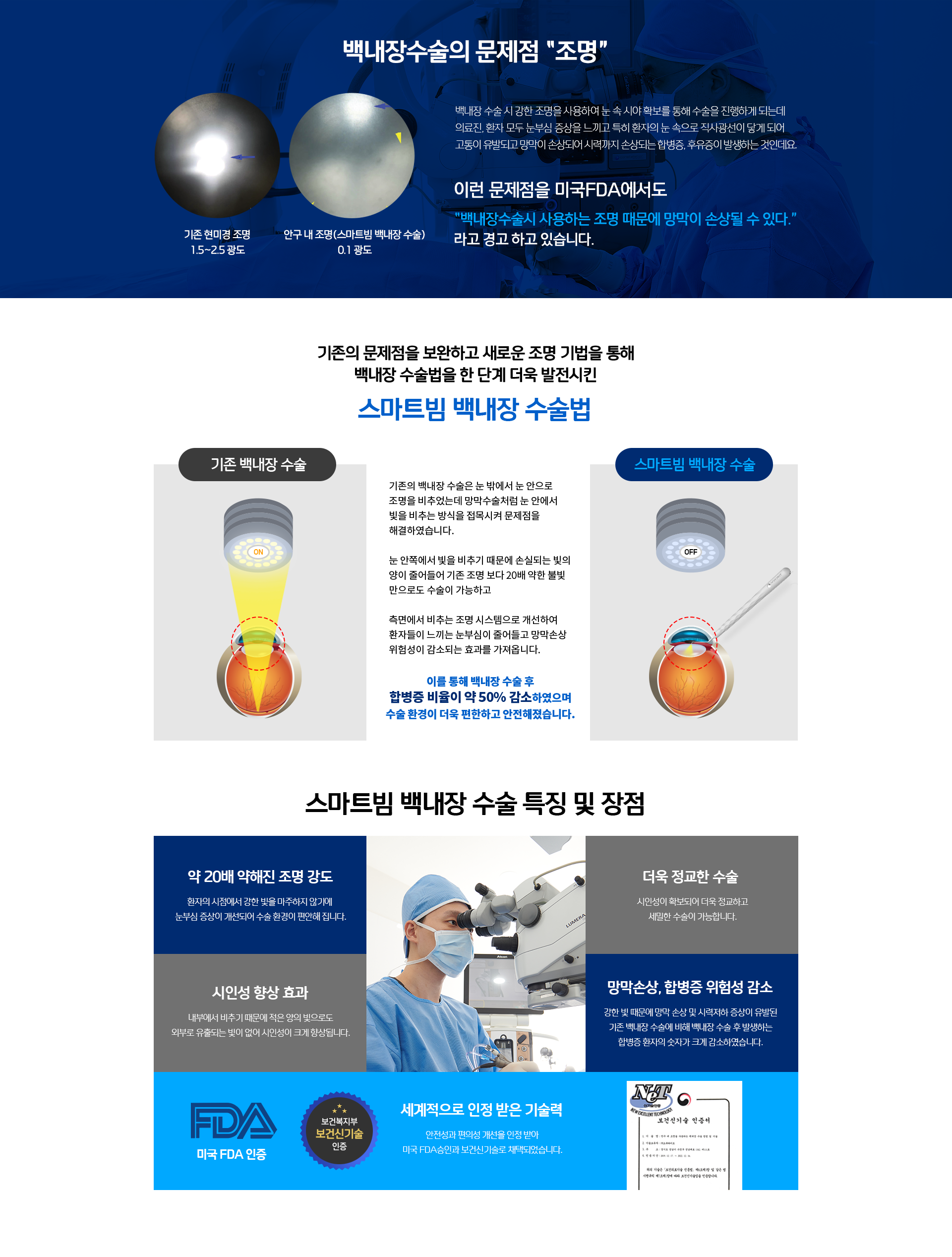 스마트빔 백내장수술은 합병증 비율이 50% 감소, 20배 약해진 조명강도, 망막손상, 합병증 위험감소, 미국FDA인증 