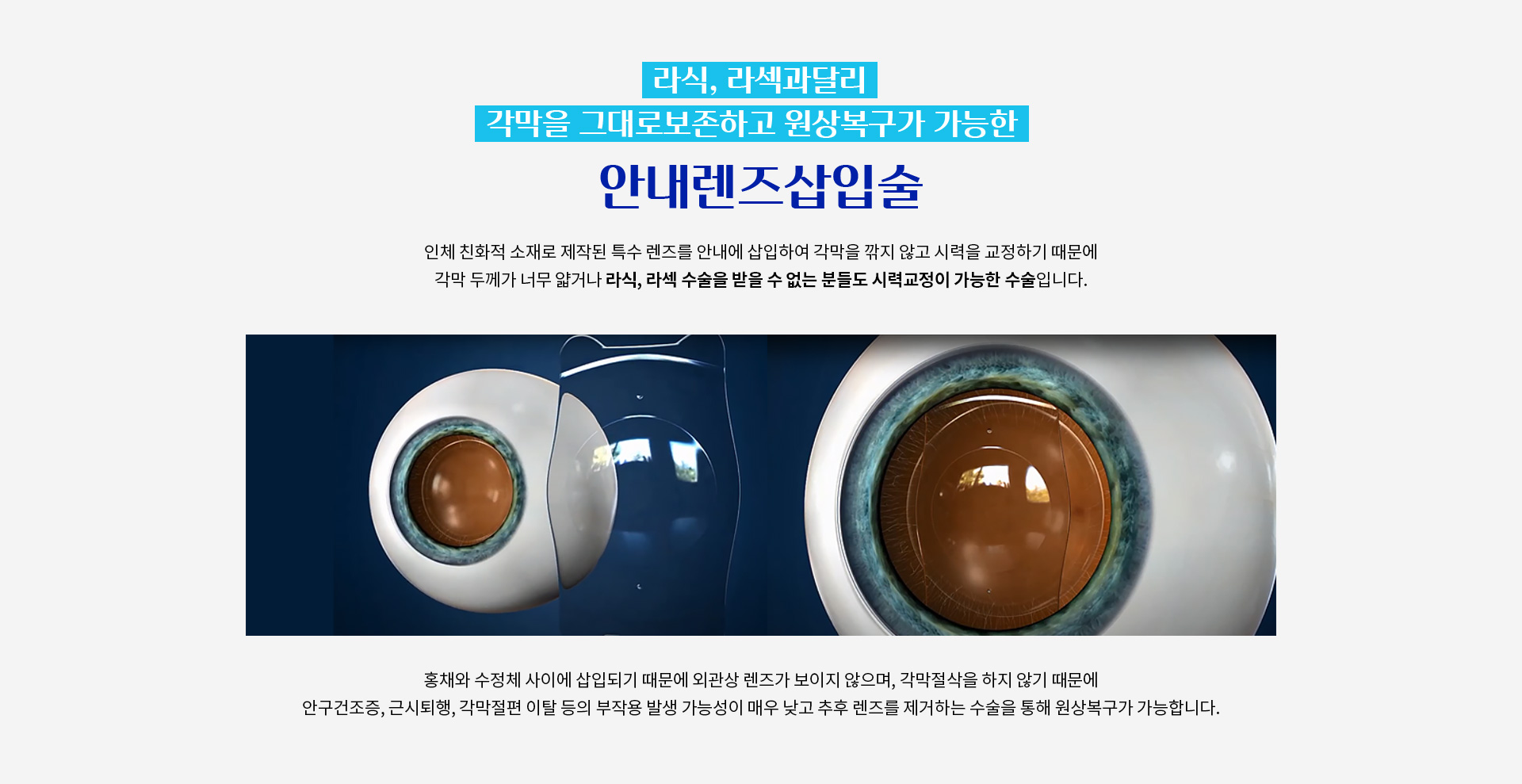 라식, 라섹 수술을 받을 수 없는 분들도 시력교정이 가능한 수술입니다. 