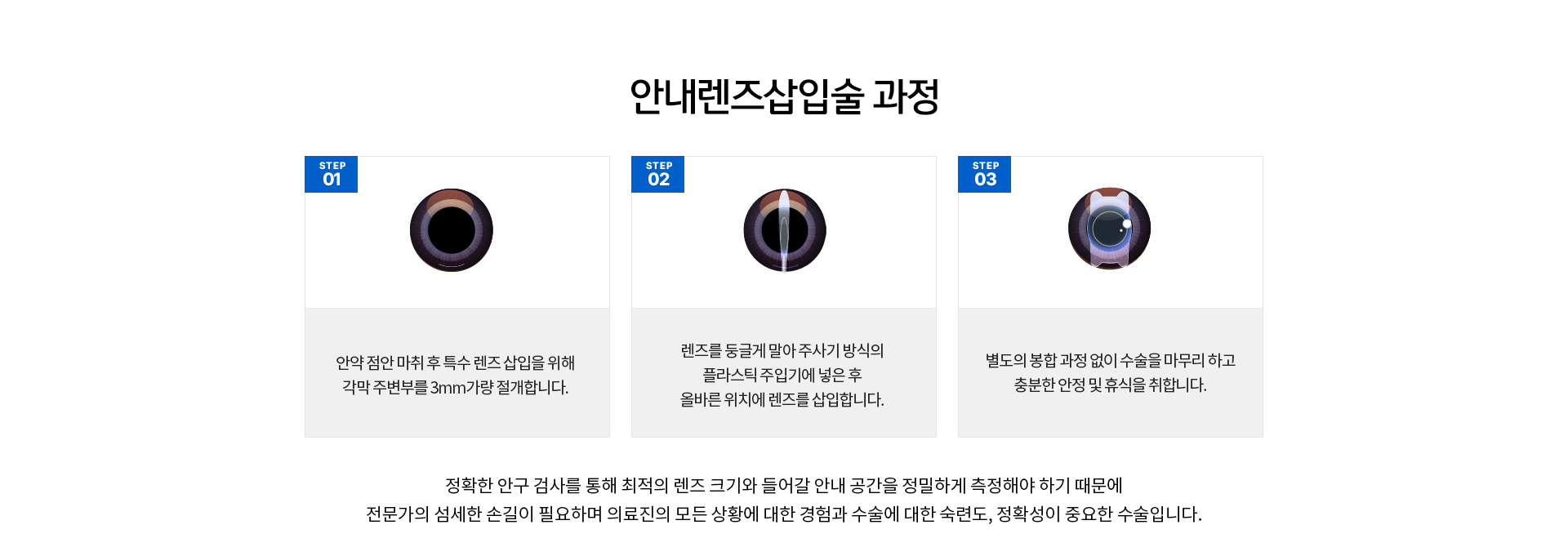 삽입술과정, 각막 주변부를 3mm 가량 절개, 주사기 방식의 플라스틱 주입기에 넣은 후 올바른 위치에 삽입, 별도 봉합 없이 수술을 마무리하고 휴식을 취합니다. 