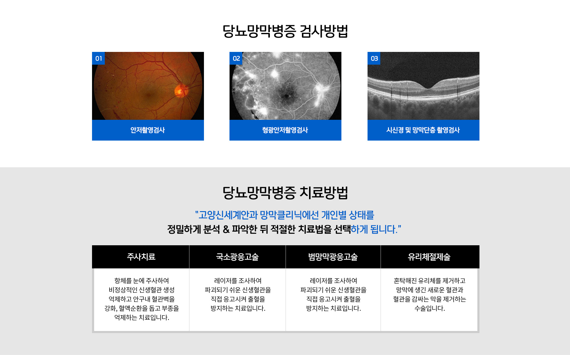 치료방법, 주사치료, 국소광응고술, 범망막광응고술, 유리체절제술