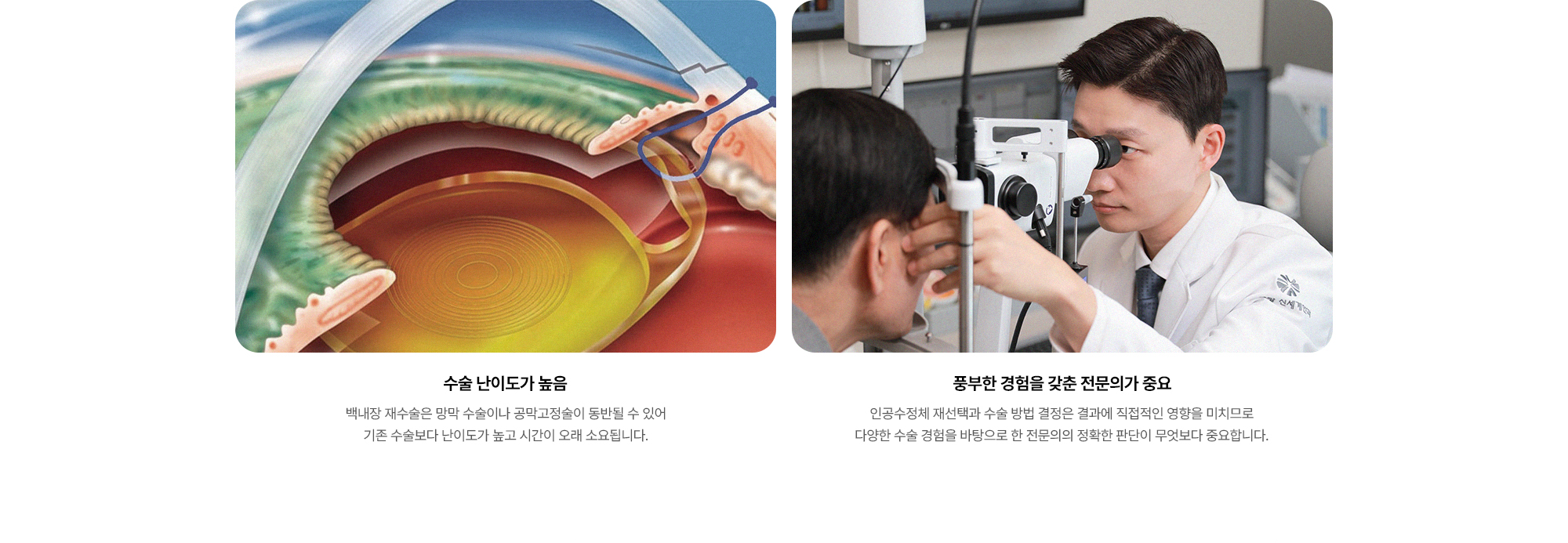 {수술 난이도가 높음} 백내장 재수술은 망막 수술이나 공막고정술이 동반될 수 있어 기존 수술보다 난이도가 높고 시간이 오래 소요됩니다. / {풍부한 경험을 갖춘 전문의가 중요} 인공수정체 재선택과 수술 방법 결정은 결과에 직접적인 영향을 미치므로 다양한 수술 경험을 바탕으로 한 전문의의 정확한 판단이 무엇보다 중요합니다.
