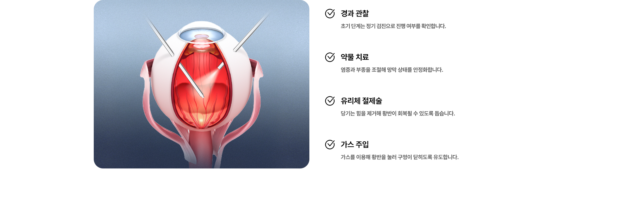 (1) 경과 관찰:초기 단계는 정기 검진으로 진행 여부를 확인합니다. (2) 약물 치료:염증과 부종을 조절해 망막 상태를 안정화합니다. (3) 유리체 절제술:당기는 힘을 제거해 황반이 회복될 수 있도록 돕습니다. (4) 가스 주입:가스를 이용해 황반을 눌러 구멍이 닫히도록 유도합니다.