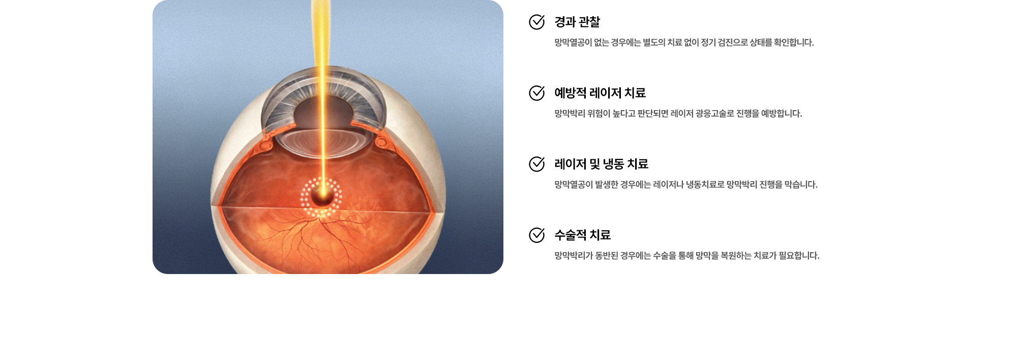 (1) 경과 관찰:망막열공이 없는 경우에는 별도의 치료 없이 정기 검진으로 상태를 확인합니다. (2) 예방적 레이저 치료:망막박리 위험이 높다고 판단되면 레이저 광응고술로 진행을 예방합니다. (3) 레이저 및 냉동 치료:망막열공이 발생한 경우에는 레이저나 냉동치료로 망막박리 진행을 막습니다. (4) 수술적 치료:망막박리가 동반된 경우에는 수술을 통해 망막을 복원하는 치료가 필요합니다.