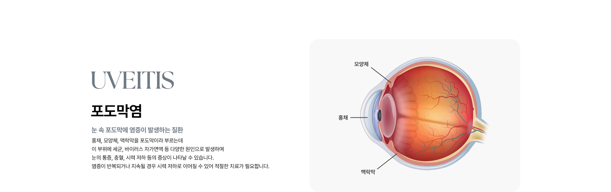 [포도막염 : 눈 속 포도막에 염증이 발생하는 질환] 세균, 바이러스, 자가면역 반응 등 다양한 원인으로 발생하며 눈의 통증, 충혈, 시력 저하 등의 증상이 나타날 수 있습니다. 염증이 반복되거나 지속될 경우 시력 저하로 이어질 수 있어 적절한 치료가 필요합니다.