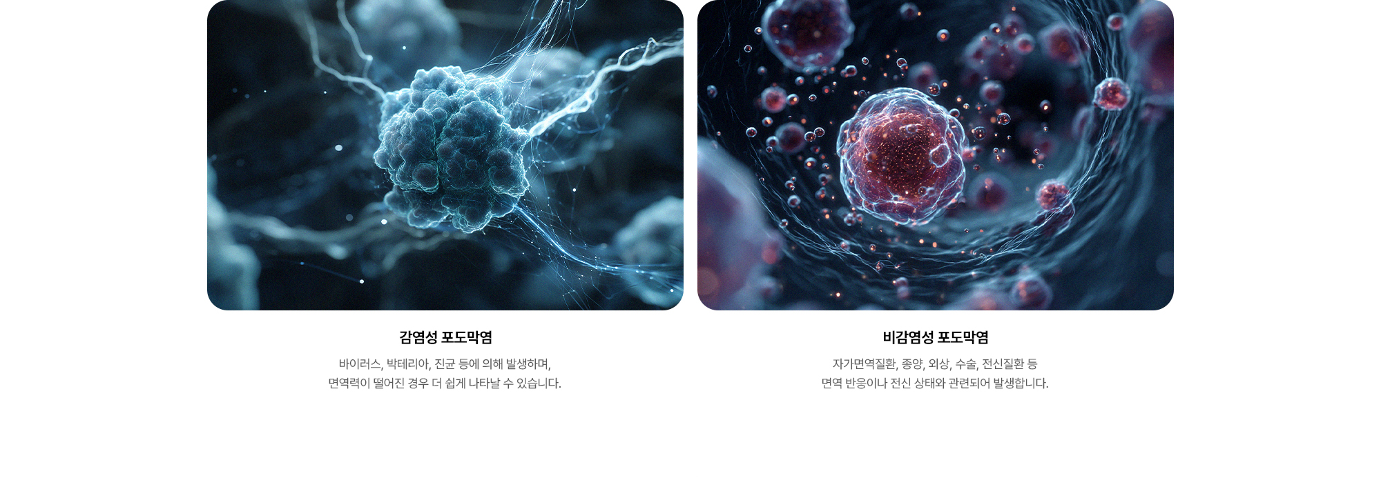 {감염성 포도막염} 바이러스, 박테리아, 진균 등에 의해 발생하며, 면역력이 떨어진 경우 더 쉽게 나타날 수 있습니다. {비감염성 포도막염} 자가면역질환, 종양, 외상, 수술, 전신질환 등 면역 반응이나 전신 상태와 관련되어 발생합니다.