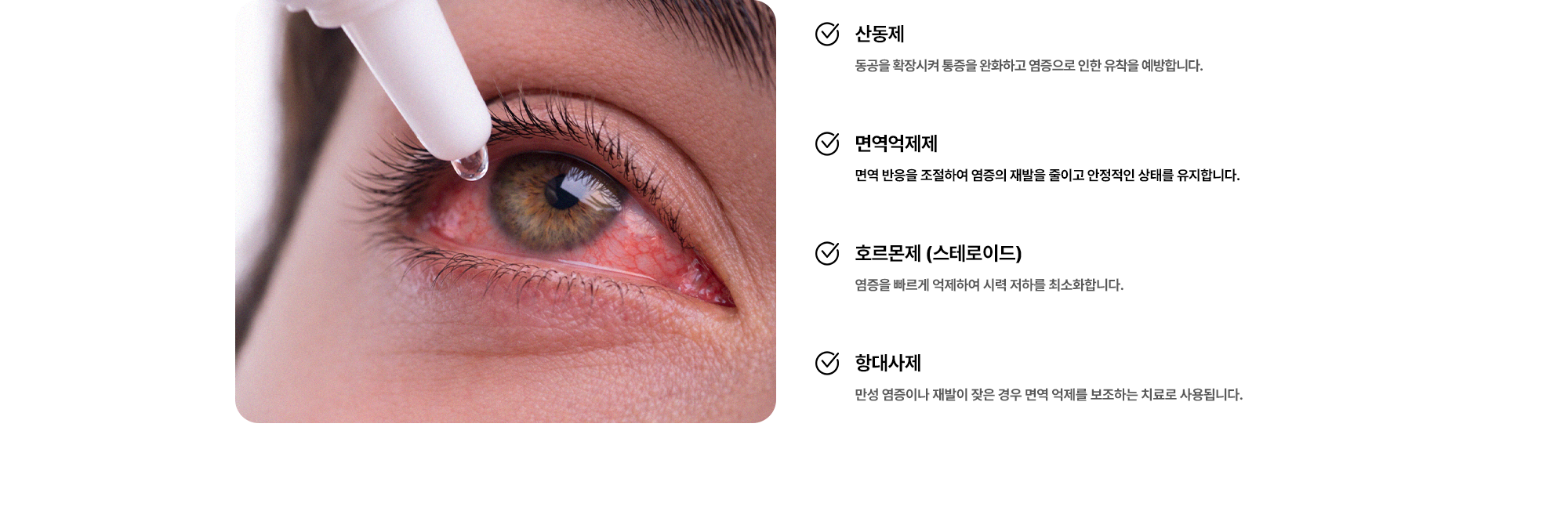(1) 산동제:동공을 확장시켜 통증을 완화하고 염증으로 인한 유착을 예방합니다. (2) 면역억제제:면역 반응을 조절하여 염증의 재발을 줄이고 안정적인 상태를 유지합니다. (3) 호르몬제 (스테로이드):염증을 빠르게 억제하여 시력 저하를 최소화합니다. (4) 항대사제:만성 염증이나 재발이 잦은 경우 면역 억제를 보조하는 치료로 사용됩니다.