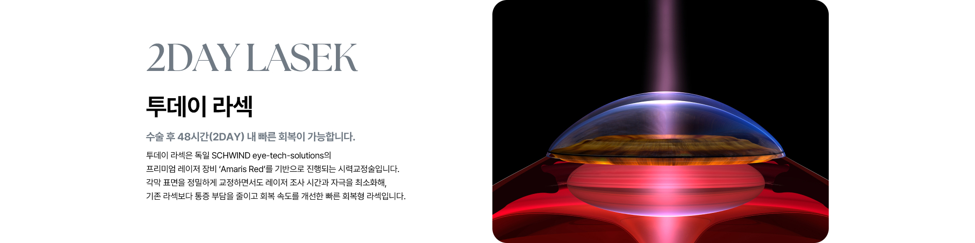 [투데이 라섹 : 수술 후 48시간(2DAY) 내 빠른 회복이 가능합니다.] 투데이 라섹은 각막 표면을 정밀하게 교정하면서도 레이저 조사 시간과 자극을 최소화해, 기존 라섹보다 통증 부담을 줄이고 회복 속도를 개선한 빠른 회복형 라섹입니다.