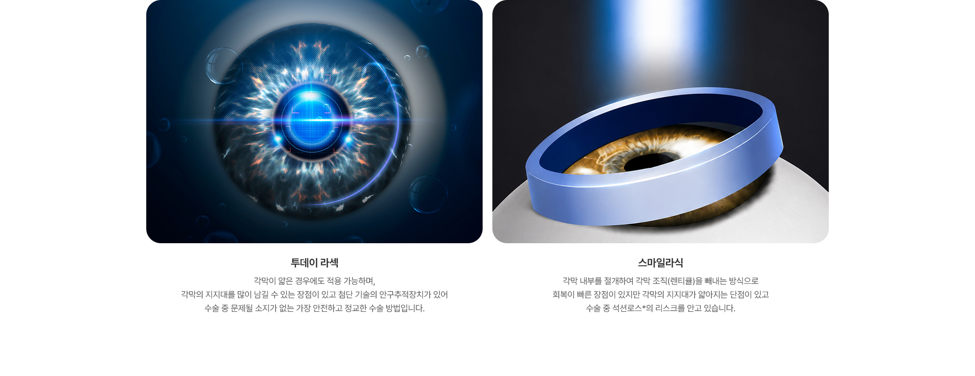 {투데이 라섹} 각막이 얇은 경우에도 적용 가능하며, 각막의 지지대를 많이 남길 수 있는 장점이 있고 첨단 기술의 안구추적장치가 있어 수술 중 문제될 소지가 없는 가장 안전하고 정교한 수술 방법입니다. {스마일라식} 각막 내부를 절개하여 각막 조직(렌티큘)을 빼내는 방식으로 회복이 빠른 장점이 있지만 각막의 지지대가 얇아지는 단점이 있고 수술 중 석션로스*의 리스크를 안고 있습니다.