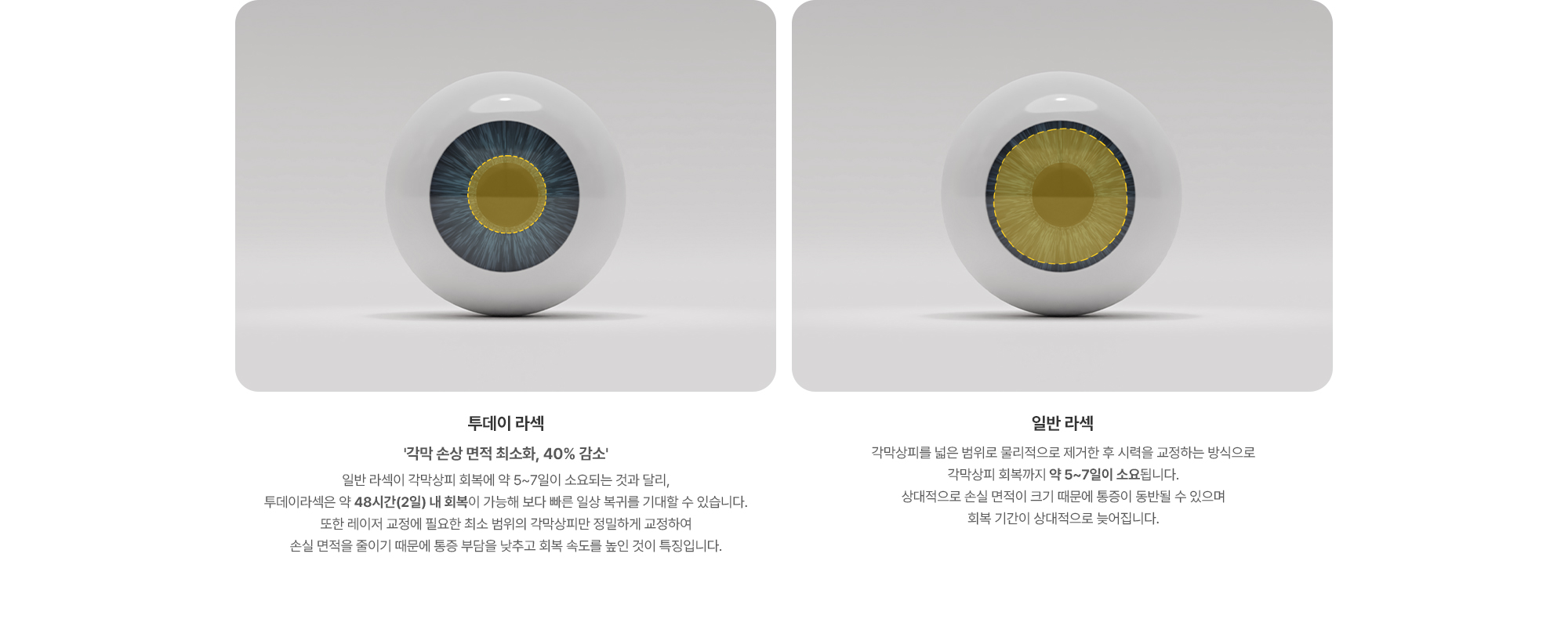 {투데이 라섹} 일반 라섹이 각막상피 회복에 약 5~7일이 소요되는 것과 달리, 투데이라섹은 약 48시간(2일) 내 회복이 가능해 보다 빠른 일상 복귀를 기대할 수 있습니다. 또한 레이저 교정에 필요한 최소 범위의 각막상피만 정밀하게 교정하여 손실 면적을 줄이기 때문에 통증 부담을 낮추고 회복 속도를 높인 것이 특징입니다. {일반 라섹} 각막상피를 넓은 범위로 물리적으로 제거한 후 시력을 교정하는 방식으로 각막상피 회복까지 약 5~7일이 소요됩니다. 상대적으로 손실 면적이 크기 때문에 통증이 동반될 수 있으며 회복 기간이 상대적으로 늦어집니다.